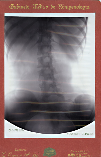 Caesar Comas & Agustí Prió - Large X-Ray of a Woman